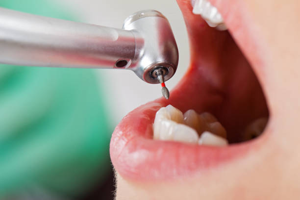Best Emergency Root Canal Treatment in Bryant, AR